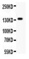 Ataxin 2 antibody, PA5-78846, Invitrogen Antibodies, Western Blot image 