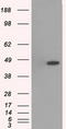 Mitogen-Activated Protein Kinase 12 antibody, LS-C114599, Lifespan Biosciences, Western Blot image 