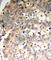 Protein Tyrosine Phosphatase Non-Receptor Type 6 antibody, AP0440, ABclonal Technology, Immunohistochemistry paraffin image 