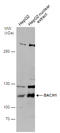 BTB Domain And CNC Homolog 1 antibody, GTX131429, GeneTex, Western Blot image 