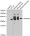 Afar antibody, GTX65900, GeneTex, Western Blot image 