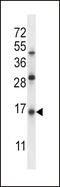 Surfactant Protein C antibody, 57-199, ProSci, Western Blot image 