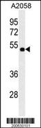 Matrix Metallopeptidase 14 antibody, MBS9200388, MyBioSource, Western Blot image 