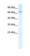 Protein Inhibitor Of Activated STAT 2 antibody, orb329846, Biorbyt, Western Blot image 