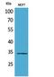 WD repeat domain-containing protein 83 antibody, STJ96810, St John