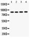 NADPH Oxidase 5 antibody, PA1947, Boster Biological Technology, Western Blot image 