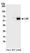 Linker for activation of X cells antibody, A304-459A, Bethyl Labs, Western Blot image 