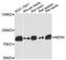 Nexilin F-Actin Binding Protein antibody, A06648, Boster Biological Technology, Western Blot image 