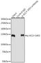 ATP Citrate Lyase antibody, LS-C750588, Lifespan Biosciences, Immunoprecipitation image 
