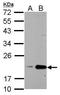 Peptidylprolyl Isomerase B antibody, GTX118372, GeneTex, Western Blot image 