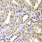 Mitogen-Activated Protein Kinase Kinase 4 antibody, STJ110035, St John