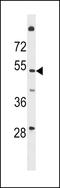 Transmembrane Protein 161A antibody, LS-C156193, Lifespan Biosciences, Western Blot image 