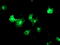 Transmembrane P24 Trafficking Protein 1 antibody, M12148, Boster Biological Technology, Western Blot image 