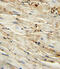 Endoglin antibody, 61-573, ProSci, Immunohistochemistry paraffin image 