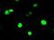Rho GDP Dissociation Inhibitor Alpha antibody, GTX84860, GeneTex, Immunocytochemistry image 