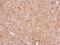 RIO Kinase 3 antibody, GTX107514, GeneTex, Immunohistochemistry paraffin image 