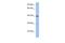 Zinc Finger Protein 474 antibody, A18228, Boster Biological Technology, Western Blot image 