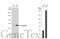 Acyl-CoA Dehydrogenase Very Long Chain antibody, GTX114232, GeneTex, Western Blot image 