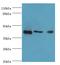 Ataxin 3 antibody, MBS7000065, MyBioSource, Western Blot image 