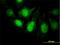 Protein Phosphatase 3 Regulatory Subunit B, Alpha antibody, H00005534-M01, Novus Biologicals, Immunofluorescence image 
