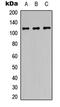 Protein Phosphatase 1 Regulatory Subunit 13B antibody, LS-C354459, Lifespan Biosciences, Western Blot image 