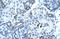 Paired Box 2 antibody, 27-248, ProSci, Immunohistochemistry paraffin image 