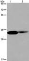 LIM Zinc Finger Domain Containing 1 antibody, PA5-50440, Invitrogen Antibodies, Western Blot image 