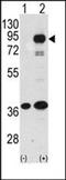 Fyn Related Src Family Tyrosine Kinase antibody, orb213949, Biorbyt, Western Blot image 