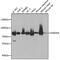 Hydroxyacyl-CoA Dehydrogenase Trifunctional Multienzyme Complex Subunit Alpha antibody, GTX32642, GeneTex, Western Blot image 