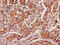 Indolethylamine N-Methyltransferase antibody, CSB-PA011723LA01HU, Cusabio, Immunohistochemistry paraffin image 
