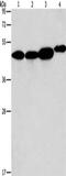 ADP Ribosylation Factor GTPase Activating Protein 1 antibody, CSB-PA232631, Cusabio, Western Blot image 