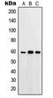 Protein Kinase C Substrate 80K-H antibody, MBS820370, MyBioSource, Western Blot image 