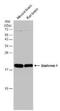 Stathmin 1 antibody, NBP1-30883, Novus Biologicals, Western Blot image 