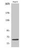 I10R1 antibody, A03597, Boster Biological Technology, Western Blot image 