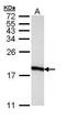 Eukaryotic Translation Initiation Factor 5A antibody, PA5-29204, Invitrogen Antibodies, Western Blot image 