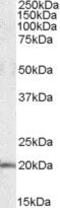 U2 Small Nuclear RNA Auxiliary Factor 1 Like 4 antibody, PA5-18826, Invitrogen Antibodies, Western Blot image 