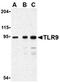 Toll Like Receptor 9 antibody, ADI-905-730-100, Enzo Life Sciences, Western Blot image 