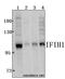 Interferon Induced With Helicase C Domain 1 antibody, A00263-1, Boster Biological Technology, Western Blot image 