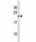 Triggering Receptor Expressed On Myeloid Cells 2 antibody, F47210-0.4ML, NSJ Bioreagents, Western Blot image 
