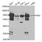Endoglin antibody, TA332807, Origene, Western Blot image 