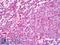 Protein Tyrosine Kinase 2 Beta antibody, LS-B7507, Lifespan Biosciences, Immunohistochemistry frozen image 