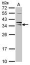 Siah E3 Ubiquitin Protein Ligase 1 antibody, PA5-29682, Invitrogen Antibodies, Western Blot image 