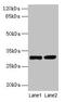 Ubiquinol-Cytochrome C Reductase Complex III Subunit VII antibody, LS-B11256, Lifespan Biosciences, Western Blot image 