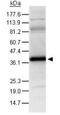 Hypoxia Inducible Factor 1 Subunit Alpha Inhibitor antibody, GTX30646, GeneTex, Western Blot image 