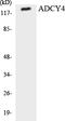 Adenylate Cyclase 4 antibody, LS-C200088, Lifespan Biosciences, Western Blot image 