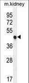 Cyclin Dependent Kinase Inhibitor 1C antibody, LS-C168622, Lifespan Biosciences, Western Blot image 