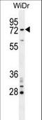 BRCA1 Associated RING Domain 1 antibody, LS-C156736, Lifespan Biosciences, Western Blot image 