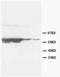GFAP antibody, AM20624PU-N, Origene, Western Blot image 
