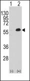 Myocyte Enhancer Factor 2C antibody, LS-C100010, Lifespan Biosciences, Western Blot image 