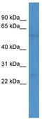 Calcium/calmodulin-dependent 3 ,5 -cyclic nucleotide phosphodiesterase 1A antibody, TA335729, Origene, Western Blot image 